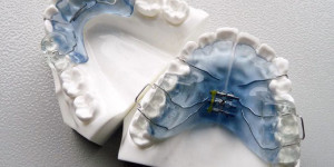 Ortopèdia dentofacial